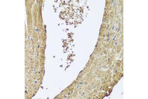 Immunohistochemistry of paraffin-embedded mouse heart using PIK3C2A antibody (ABIN5995585) at dilution of 1/100 (40x lens). (PIK3C2A antibody)