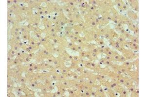 Immunohistochemistry of paraffin-embedded human liver tissue using ABIN7143695 at dilution of 1:100