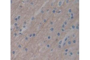 IHC-P analysis of Human Tissue, with DAB staining. (SFRP4 antibody  (AA 22-346))