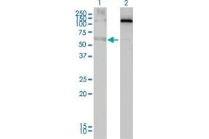 Western Blot analysis of ALAS2 expression in transfected 293T cell line by ALAS2 monoclonal antibody (M01), clone 6C1. (ALAS2 antibody  (AA 1-100))