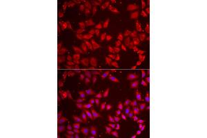 Immunofluorescence analysis of HeLa cells using BAP1 antibody (ABIN5973917). (BAP1 antibody)