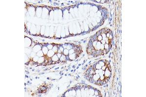 Immunohistochemistry of paraffin-embedded human colon using PTP4 antibody (ABIN7269703) at dilution of 1:100 (40x lens). (PTP4A2 antibody  (AA 30-100))