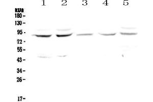 Western blot analysis of Cullin 4a using anti-Cullin 4a antibody . (Cullin 4A antibody  (AA 494-759))
