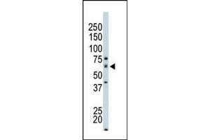 Image no. 1 for anti-P21-Activated Kinase 4 (PAK4) (N-Term) antibody (ABIN360324) (PAK4 antibody  (N-Term))