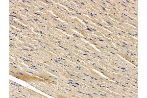 ABIN7096271 and ABIN7100333 at 1/100 staining rat muscle tissue by IHC-P. (RNF145 antibody)