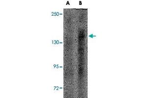 Western blot analysis of IL16 in rat brain tissue lysate with IL16 polyclonal antibody  at (A) 1 ug/mL and (B) 2 ug/mL . (IL16 antibody  (N-Term))