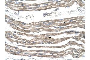 SLC25A22 antibody was used for immunohistochemistry at a concentration of 4-8 ug/ml to stain Skeletal muscle cells (arrows) in Human Muscle. (SLC25A22 antibody)
