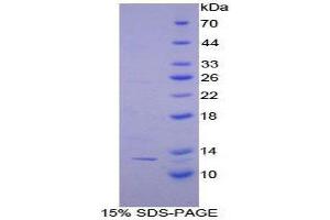 SDS-PAGE (SDS) image for Catenin, beta Interacting Protein 1 (CTNNBIP1) (AA 1-81) protein (His tag) (ABIN2124262)