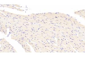 Detection of ATG7 in Mouse Heart Tissue using Polyclonal Antibody to Autophagy Related Protein 7 (ATG7) (ATG7 antibody  (AA 477-698))