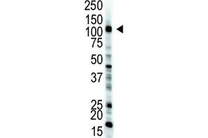 Western Blotting (WB) image for anti-E1 Ubiquitin antibody (ABIN3001449) (E1 Ubiquitin antibody)