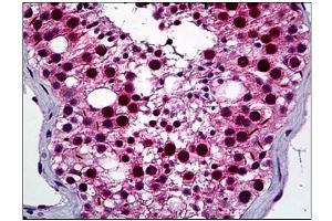 Immunohistochemistry (IHC) image for anti-NIMA (Never in Mitosis Gene A)-Related Kinase 2 (NEK2) (AA 331-445) antibody (ABIN781938) (NEK2 antibody  (AA 331-445))