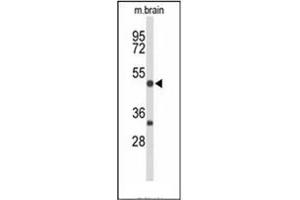 Western blot analysis of MEF2A Antibody (Center) in mouse brain tissue lysates (35ug/lane). (MEF2A antibody  (Middle Region))