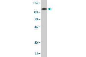 Western Blot detection against Immunogen (95. (SF3B2 antibody  (AA 1-636))