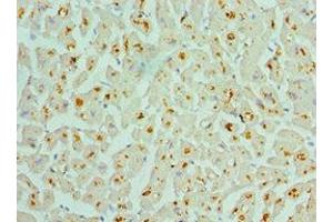 Immunohistochemistry of paraffin-embedded human heart tissue using ABIN7142986 at dilution of 1:100 (ASAH1 antibody  (AA 146-395))