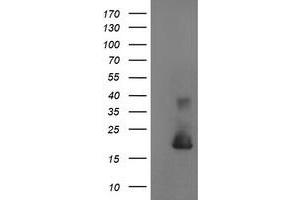Image no. 1 for anti-Cystatin S (CST4) antibody (ABIN1497667) (CST4 antibody)