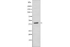 Western blot analysis of extracts from HeLa cells, using hnRNP G antibody.