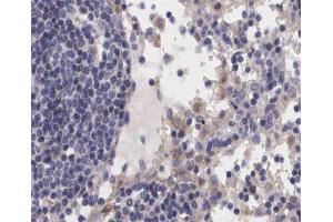 ABIN6267239 at 1/200 staining human Lymph node tissue sections by IHC-P.
