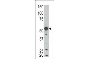 Image no. 1 for anti-B Lymphoid Tyrosine Kinase (BLK) (N-Term) antibody (ABIN359972) (BLK antibody  (N-Term))