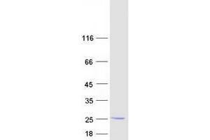 Validation with Western Blot (DESI1 Protein (Myc-DYKDDDDK Tag))