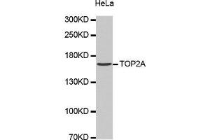 Western Blotting (WB) image for anti-Topoisomerase (DNA) II alpha 170kDa (TOP2A) antibody (ABIN1683096) (Topoisomerase II alpha antibody)