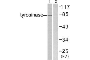 Western blot analysis of extracts from COS7 cells, treated with UV (30mins), using Tyrosinase antibody. (TYR antibody  (C-Term))