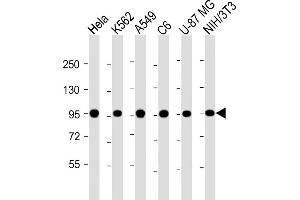 All lanes : Anti-VCP Antibody at 1:4000 dilution Lane 1: Hela whole cell lysate Lane 2: K562 whole cell lysate Lane 3: A549 whole cell lysate Lane 4: C6 whole cell lysate Lane 5: U-87 MG whole cell lysate Lane 6: NIH/3T3 whole cell lysate Lysates/proteins at 20 μg per lane. (VCP antibody)