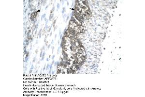 Human Stomach (ACAT2 antibody  (Middle Region))