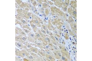 Immunohistochemistry of paraffin-embedded human liver using WDR48 antibody at dilution of 1:100 (40x lens). (WDR48 antibody)