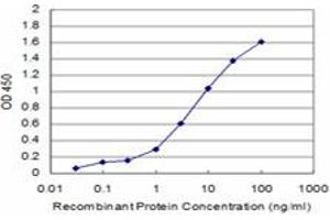 Detection limit for recombinant GST tagged BRD3 is approximately 0. (BRD3 antibody  (AA 418-556))