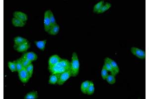 Immunofluorescent analysis of HepG2 cells using ABIN7142142 at dilution of 1:100 and Alexa Fluor 488-congugated AffiniPure Goat Anti-Rabbit IgG(H+L) (ACMSD antibody  (AA 33-129))