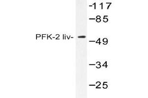 Western blot (WB) analysis of AP20411PU-N PFK-2 liv antibody in extracts from HUVEC cells.