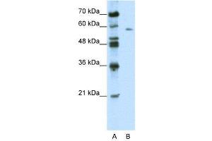 WB Suggested Anti-BTBD14A  Antibody Titration: 0. (BTBD14A antibody  (C-Term))