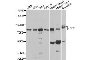 Western blot analysis of extracts of various cell lines, using NF2 antibody. (Merlin antibody  (AA 477-576))