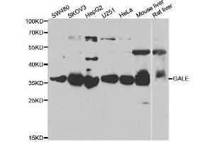 Western blot analysis of extracts of various cell lines, using GALE antibody. (GALE antibody  (AA 129-348))