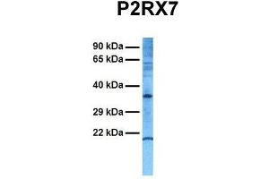 Host:  Rabbit  Target Name:  P2RX7  Sample Tissue:  Human Hela  Antibody Dilution:  1. (P2RX7 antibody  (N-Term))