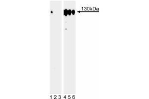 Western blot analysis of p130Cas (pY249) in human Burkitt’s lymphoma. (BCAR1 antibody  (pTyr249))