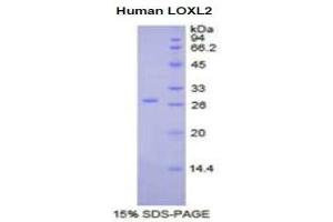 SDS-PAGE (SDS) image for Lysyl Oxidase-Like 2 (LOXL2) (AA 544-751) protein (His tag) (ABIN2121574) (LOXL2 Protein (AA 544-751) (His tag))
