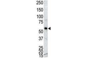 Western blot analysis of anti-CAMK 1G Pab in NCI-H460 cell lysate. (CAMK1G antibody  (C-Term))