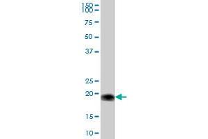 Western Blotting (WB) image for anti-Cytochrome B5 Type B (Outer Mitochondrial Membrane) (CYB5B) (AA 1-146) antibody (ABIN529305)