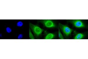 Immunocytochemistry/Immunofluorescence analysis using Rabbit Anti-GRP94 Polyclonal Antibody (ABIN1686652 and ABIN1686653). (GRP94 antibody  (C-Term))
