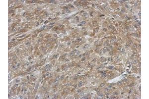 IHC-P Image Immunohistochemical analysis of paraffin-embedded U87 xenograft, using Ferredoxin Reductase, antibody at 1:500 dilution. (Ferredoxin Reductase antibody)