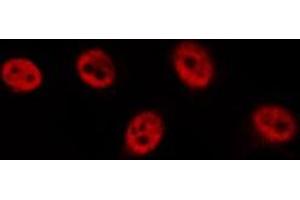 ABIN6277119 staining  HeLa cells by IF/ICC. (p63 antibody)