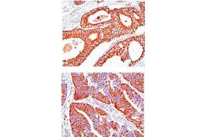Immunohistochemistry (IHC) image for anti-Heat Shock 60kDa Protein 1 (Chaperonin) (HSPD1) (AA 1-573), (N-Term) antibody (ABIN263917) (HSPD1 antibody  (N-Term))