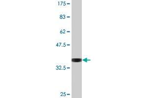 Western Blot detection against Immunogen (36. (TRIP6 antibody  (AA 1-100))