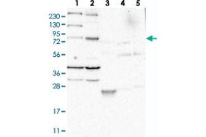 Western blot analysis of Lane 1: RT-4, Lane 2: U-251 MG, Lane 3: Human Plasma, Lane 4: Liver, Lane 5: Tonsil with LOC389813 polyclonal antibody  at 1:250-1:500 dilution. (AJM1/C9ORF172 antibody)