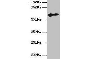 Western blot All lanes: TPTE antibody at 2 μg/mL + HepG2 whole cell lysate Secondary Goat polyclonal to rabbit IgG at 1/10000 dilution Predicted band size: 65, 63, 61, 50 kDa Observed band size: 65 kDa (TPTE antibody  (AA 175-380))