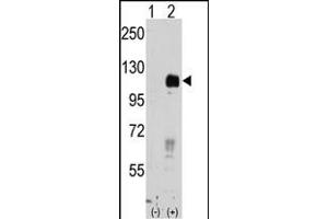 Western blot analysis of EphB4 (arrow) using rabbit polyclonal EphB4 Antibody (ABIN391924 and ABIN2841734). (EPH Receptor B4 antibody)