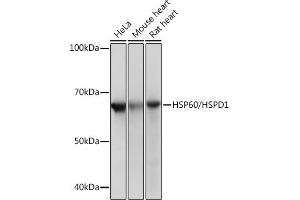 Western blot analysis of extracts of various cell lines, using HSP60/HSPD1 Rabbit mAb (ABIN1680746, ABIN3015220, ABIN3015221 and ABIN7101321) at 1:1000 dilution. (HSPD1 antibody)