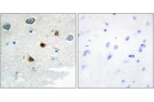 Immunohistochemistry analysis of paraffin-embedded human brain tissue, using DUSP4 Antibody. (DUSP4 antibody  (AA 81-130))