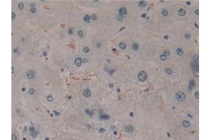 Detection of CYLD in Human Liver Tissue using Polyclonal Antibody to Cylindromatosis (CYLD)